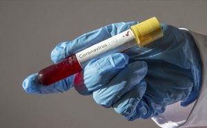 Hazırlanmaqda olan koronavirus vaksinlərinin sayı AÇIQLANIB