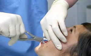 Diş çəkilərkən sinirə toxunmaq ölümə səbəb ola bilərmi? -  Stomatoloq AÇIQLADI