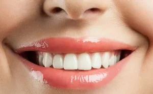 Diş sağlamlığına zərər verən qidalar -  Həkim AÇIQLADI