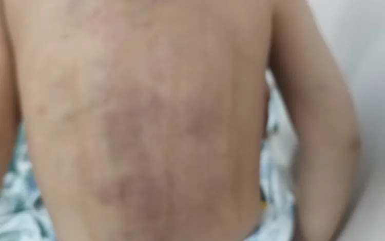 Lənkəranda atalığı 3 yaşlı uşağı döyüb? - YENİLƏNİB